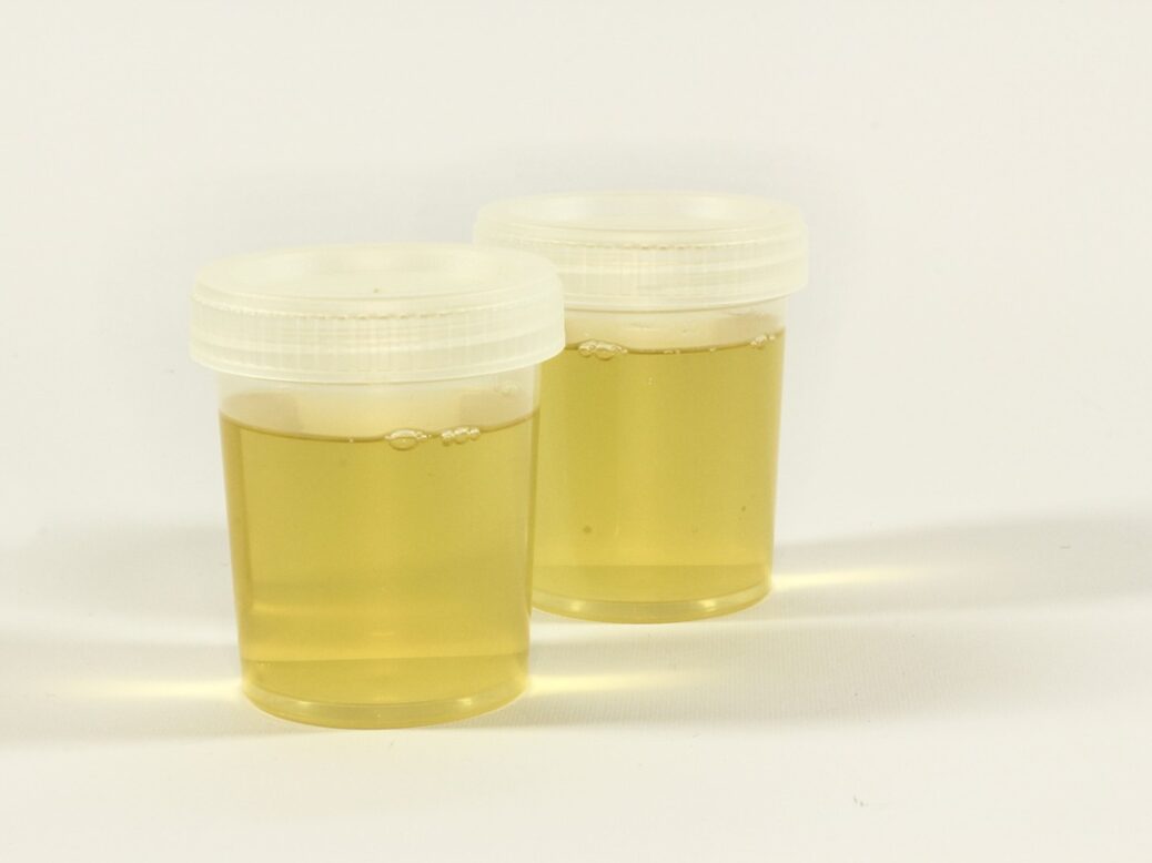 Urine